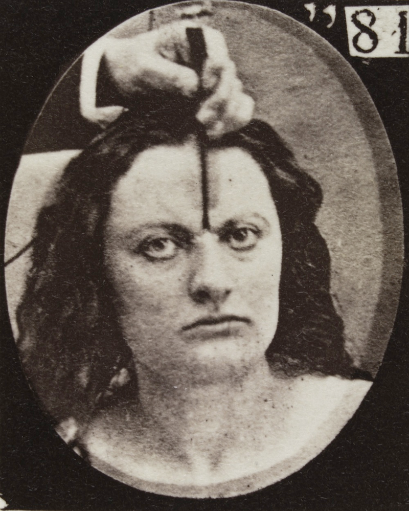 Illustration for article titled Terrifying, Century-Old Photographs from Neuroscience Experiments